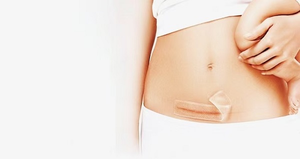 Why Are Thick Silicone Gel Scar Sheets So Popular?