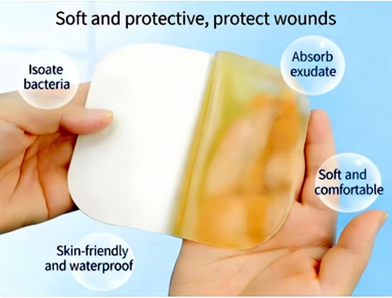 Hydrocolloid Dressings: An Innovative Choice for Wound Care