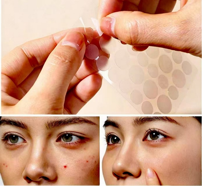 How to Use CmallBio Pimple Patches Overnight for Maximum Results？