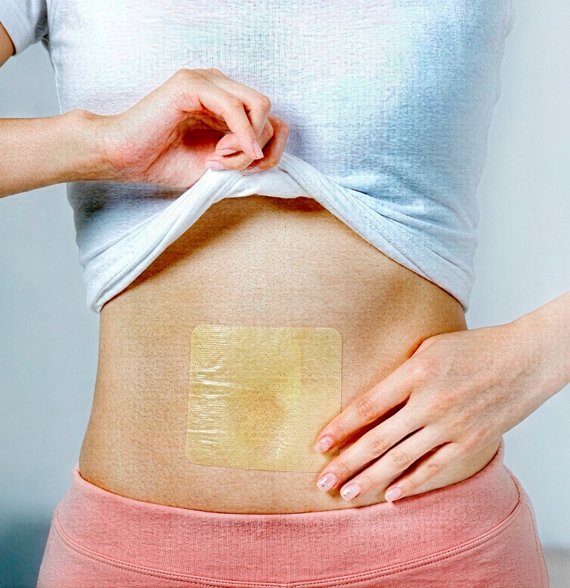 How to Manage Old Raised Scars at Home: The Growing Role of Silicone Gel Scar Sheets
