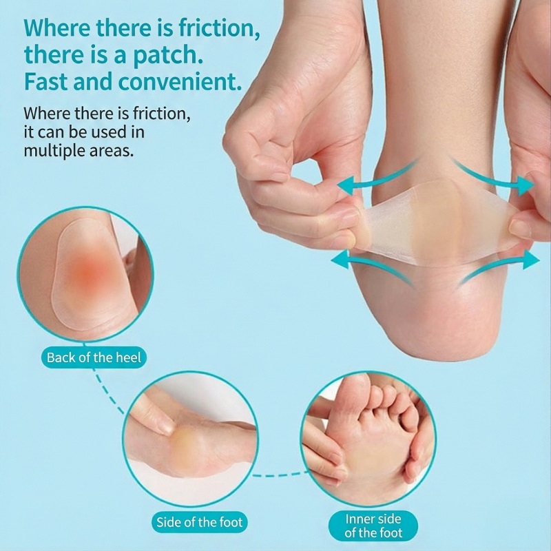 Heel Calluses and Corns: Can Hydrocolloid Soften and Relieve Them?